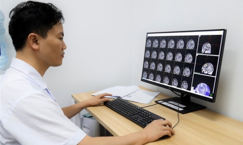 Những dấu hiệu và triệu chứng cảnh báo bệnh u não