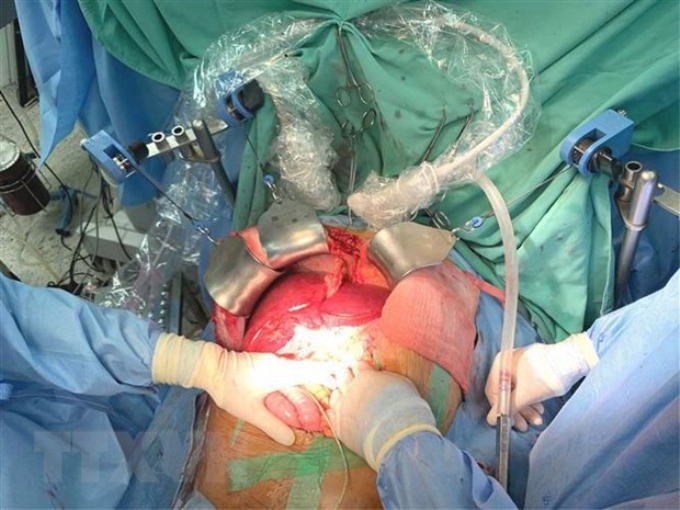 Thực hiện ghép tạng tại Bệnh viện Trung ương Huế. (Ảnh: Mai Trang/TTXVN)