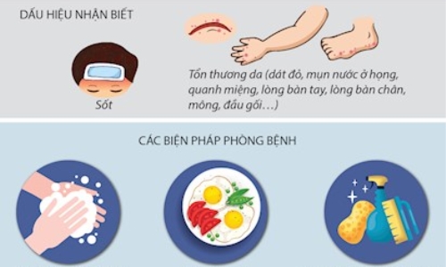 Tăng cường phòng, chốngdịch bệnh tay, chân, miệng