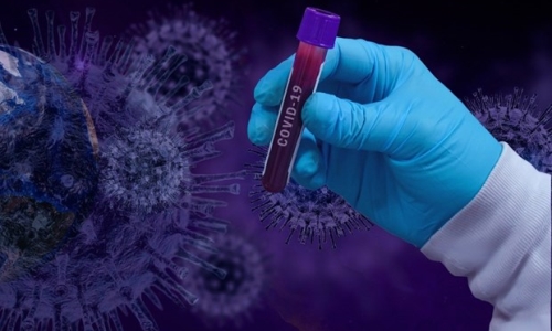 WHO tái khẳng định nguồn gốc virus SARS-CoV-2 xuất phát từ tự nhiên