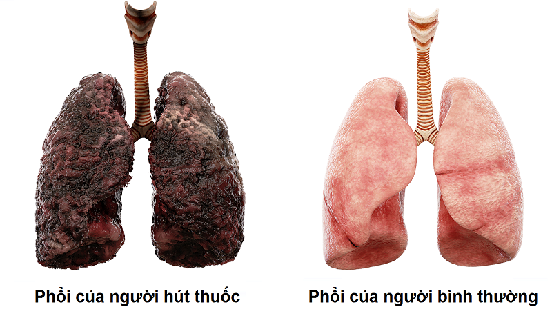 3. Các yếu tố ảnh hưởng đến sức khỏe của phổi