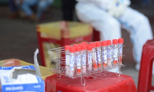 Việt Nam tăng cường năng lực xét nghiệm virus SARS-CoV-2