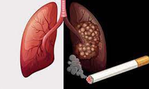 Hút thuốc lá ảnh hưởng đến phổi và chức năng phổi